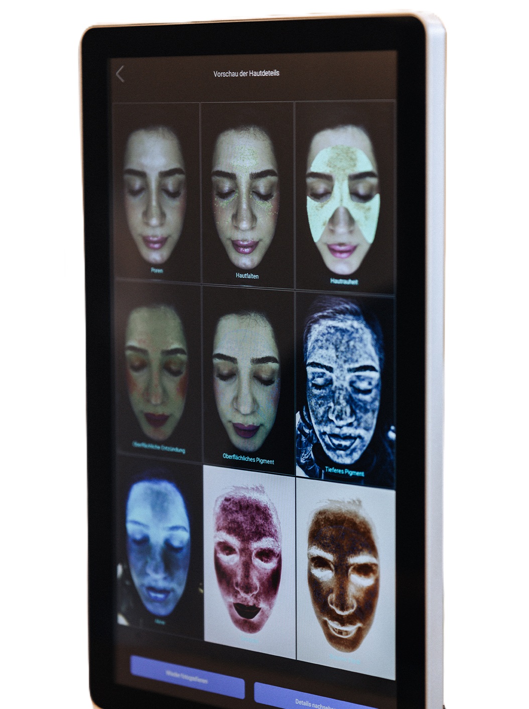 Hautbilder auf Analysebildschirm
