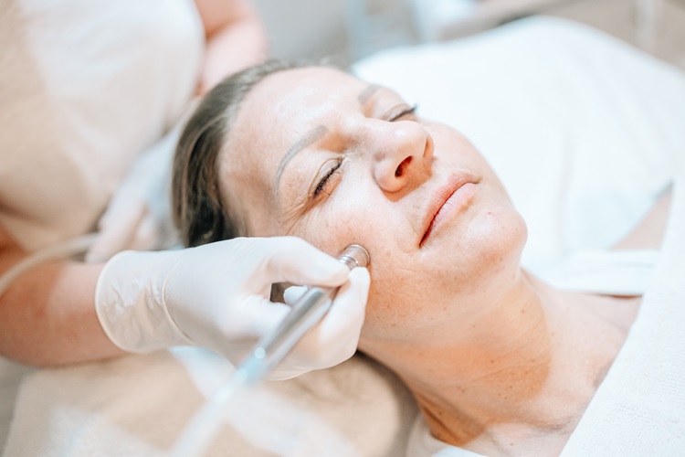 Heike Weigand behandelt eine Kundin mit Diamant-Mikrodermabrasion