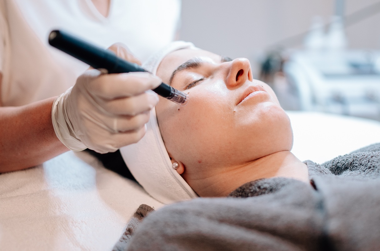 Heike Weigand behandelt eine Kundin mit Nano Needling
