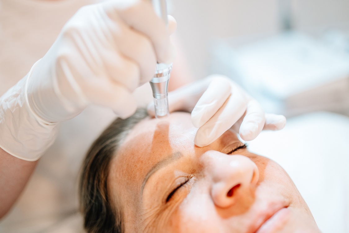 Heike Weigand behandelt eine Kundin mit Micro Needling