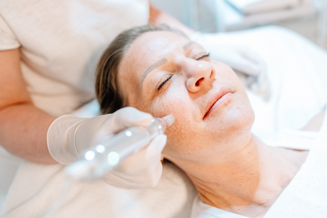 Heike Weigand behandelt eine Kundin mit Nano Needling
